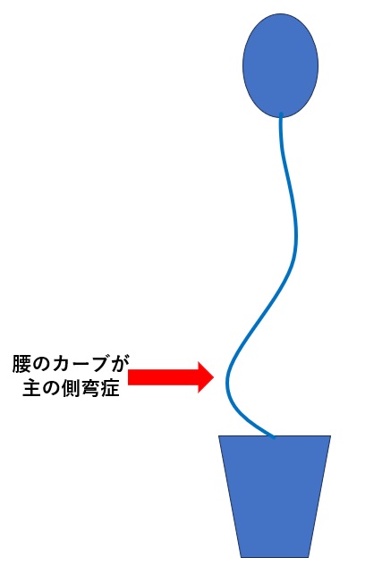 腰椎メインカーブ