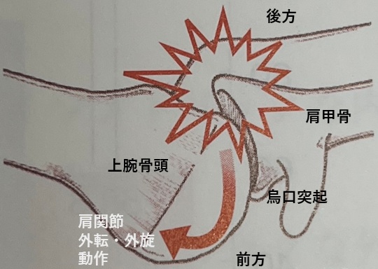 インターナルインピンジメントとは？