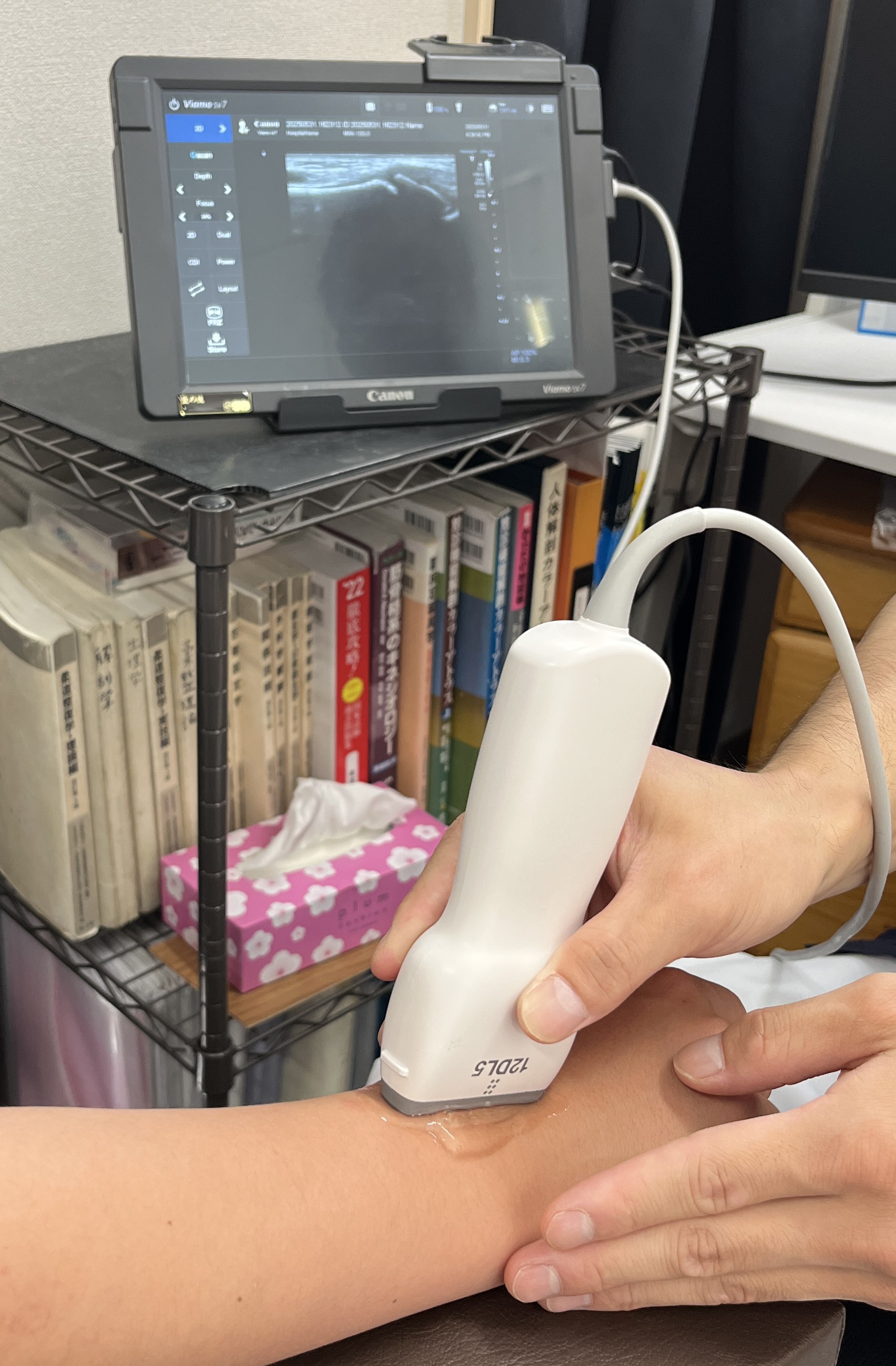 TFCC損傷の診断方法