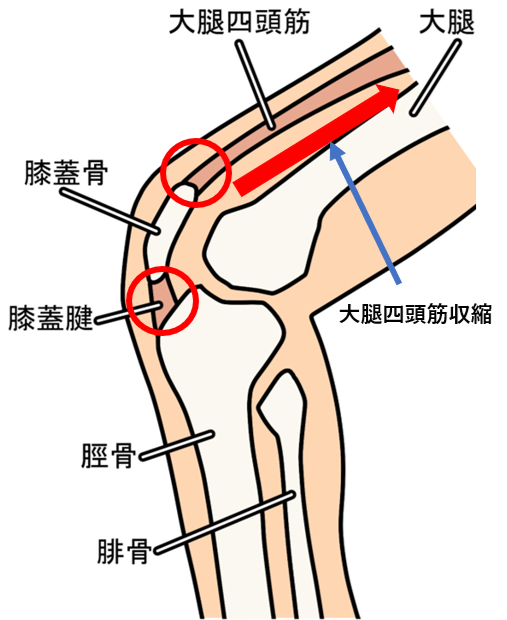 発生原因