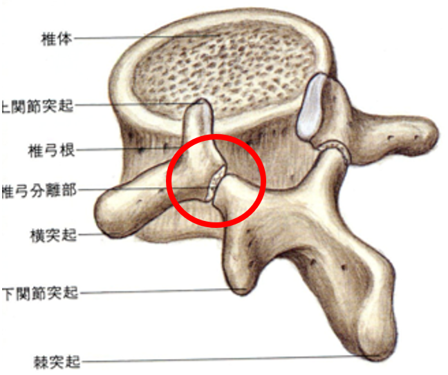 分離症2