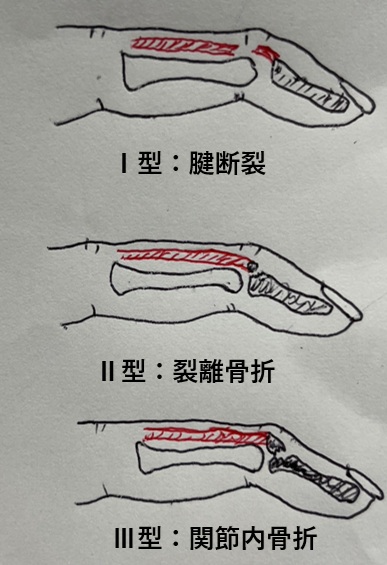 タイトルタイトルタイトル